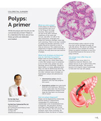 Polyps: A Primer